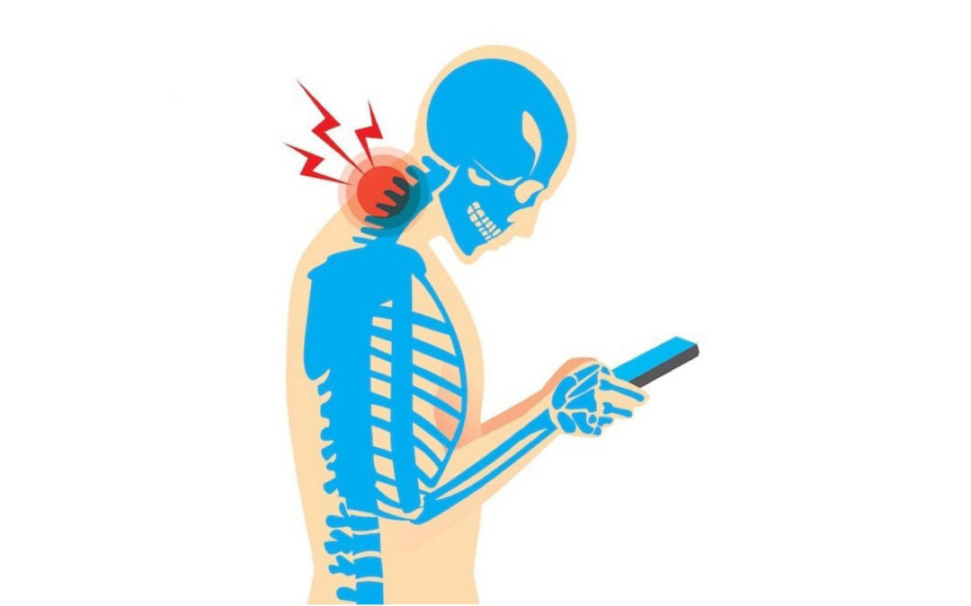 Tech Neck. Гаджеты и боль в шее – как бороться?