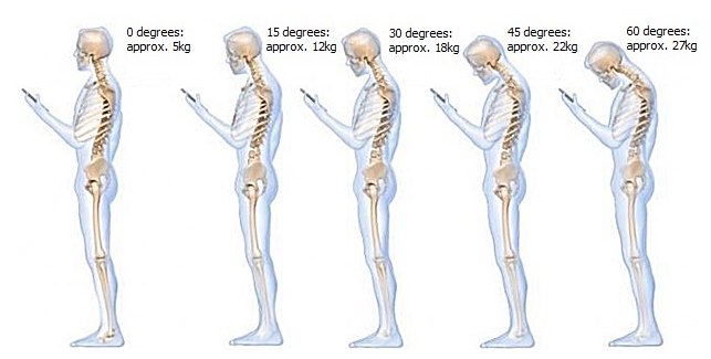 tech neck 4
